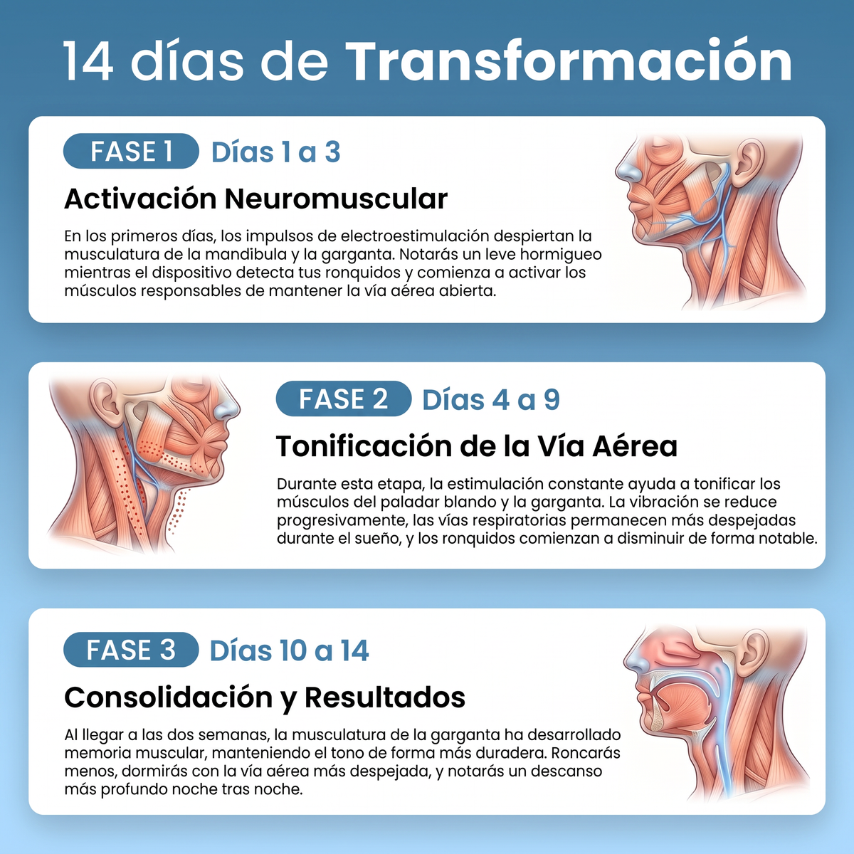 Dispositivo Inteligente Anti-Ronquidos