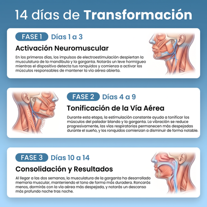 Dispositivo Inteligente Anti-Ronquidos